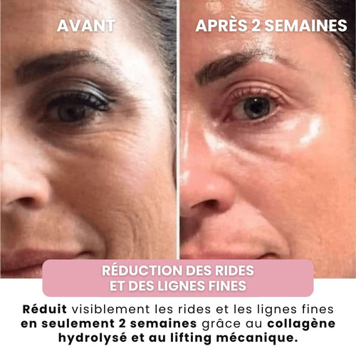 Alesia™ Masque au bio-Collagène