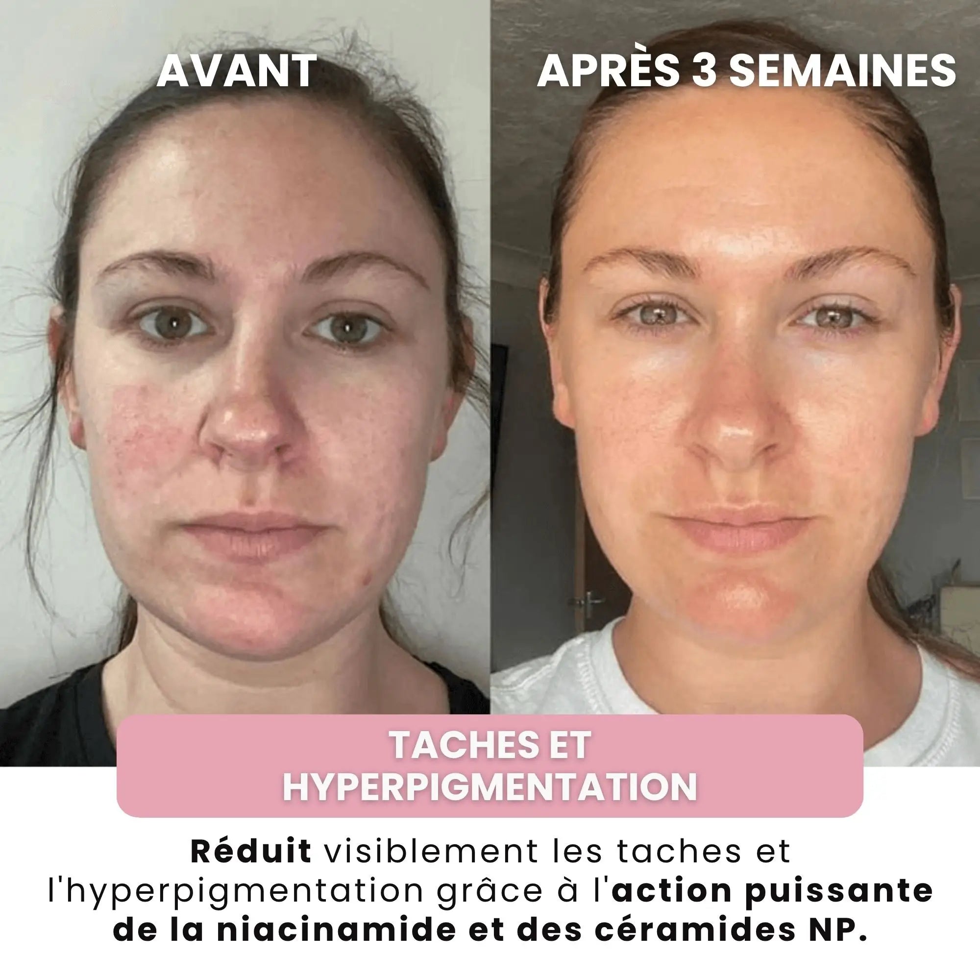 Alesia™ Masque au bio-Collagène