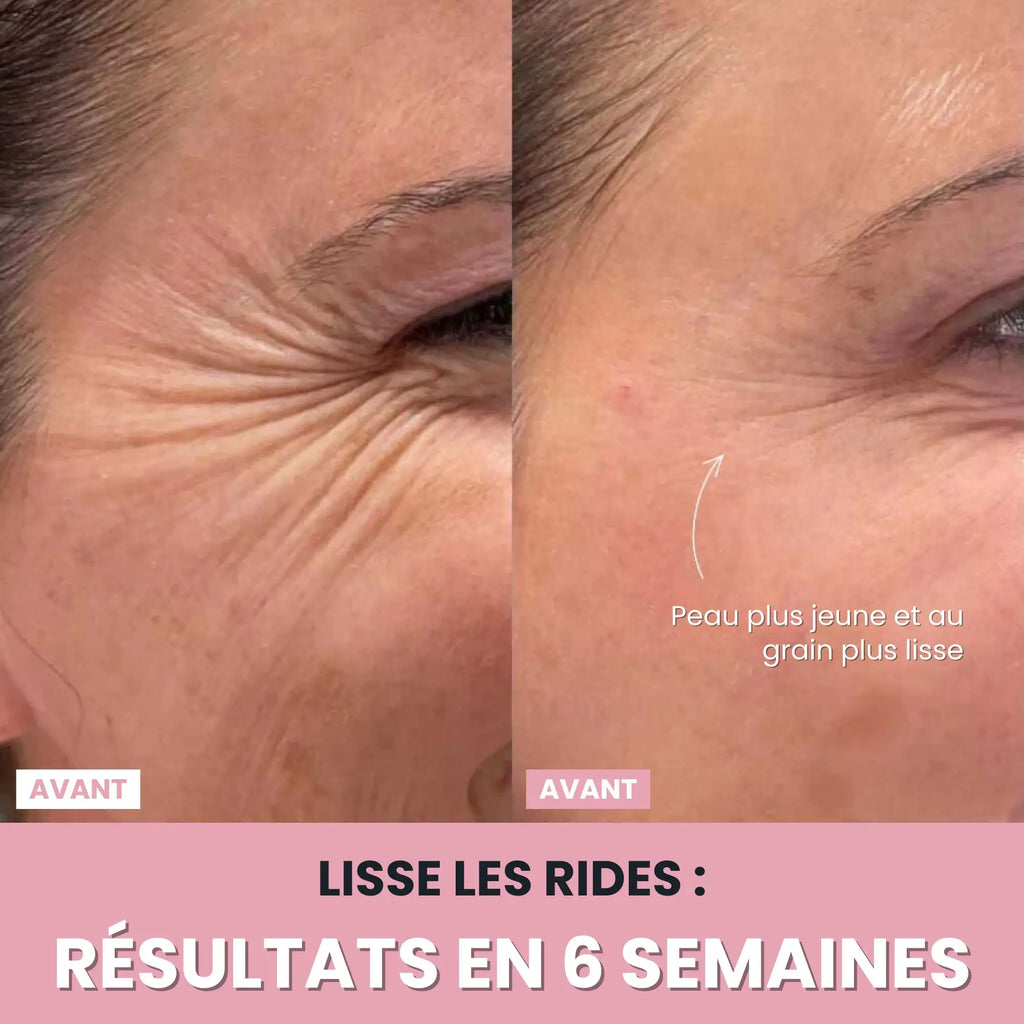 Alesia Sculteur facial LED 7 en 1