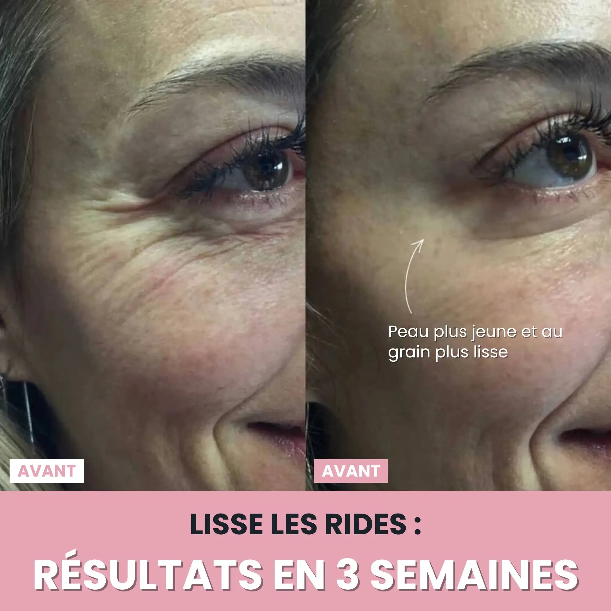 Alesia Sculteur facial LED 7 en 1