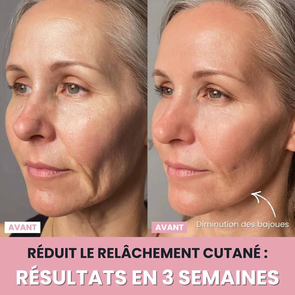 Alesia Sculteur facial LED 7 en 1