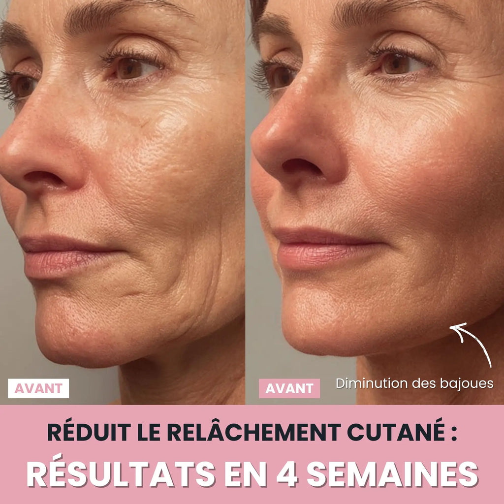 Alesia Sculteur facial LED 7 en 1