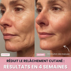 Alesia Sculteur facial LED 7 en 1