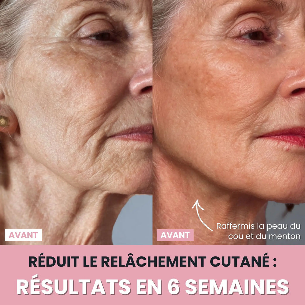 Alesia Sculteur facial LED 7 en 1