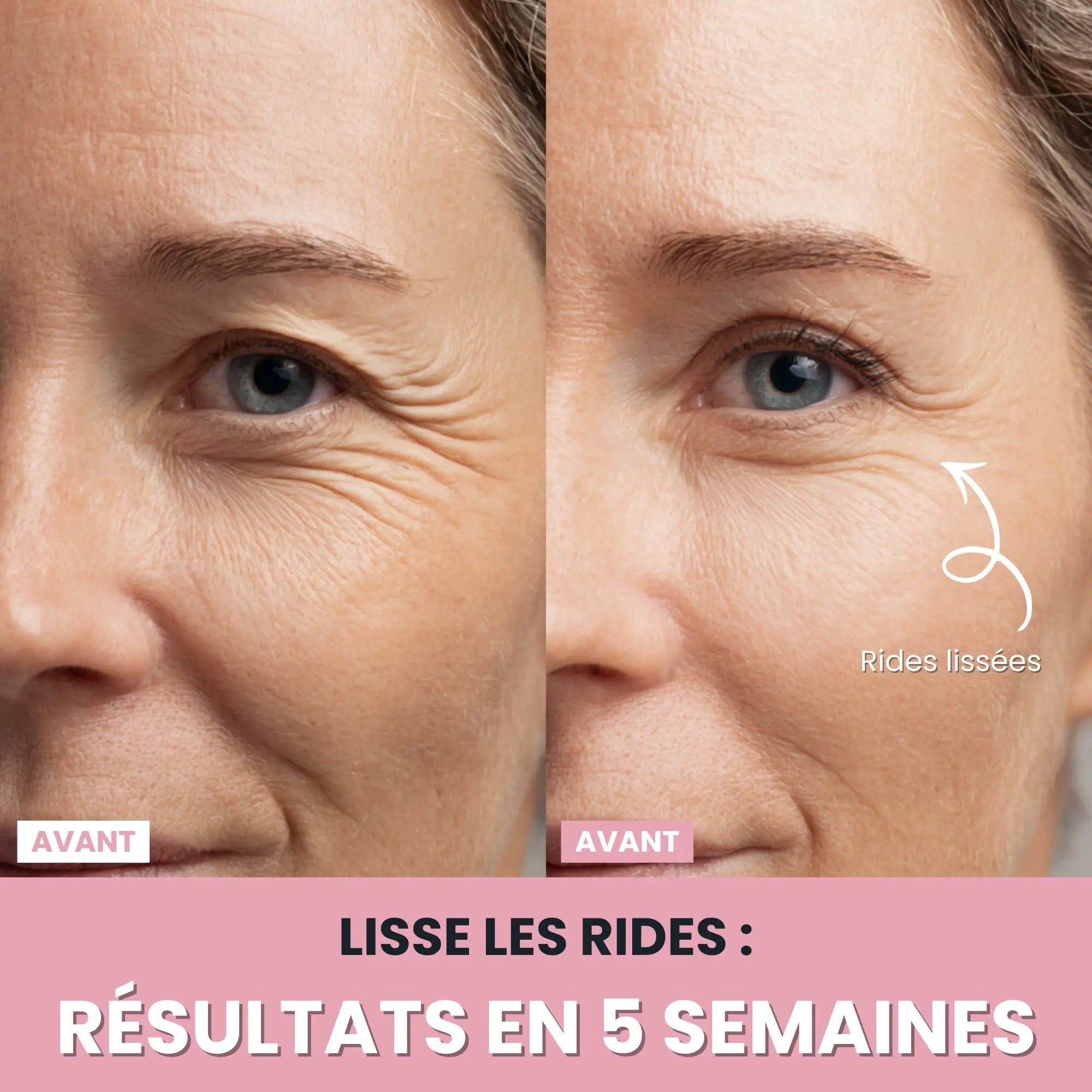 Alesia Sculteur facial LED 7 en 1