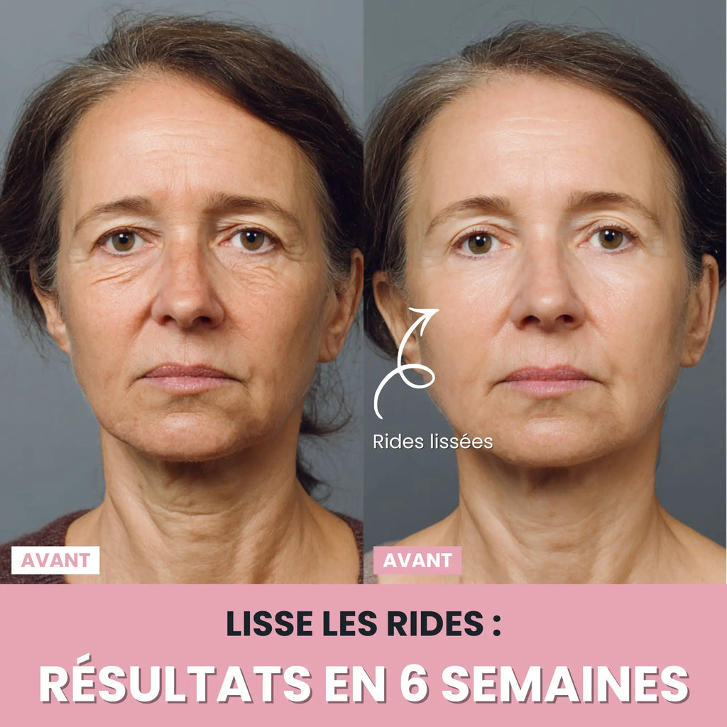 Alesia Sculteur facial LED 7 en 1
