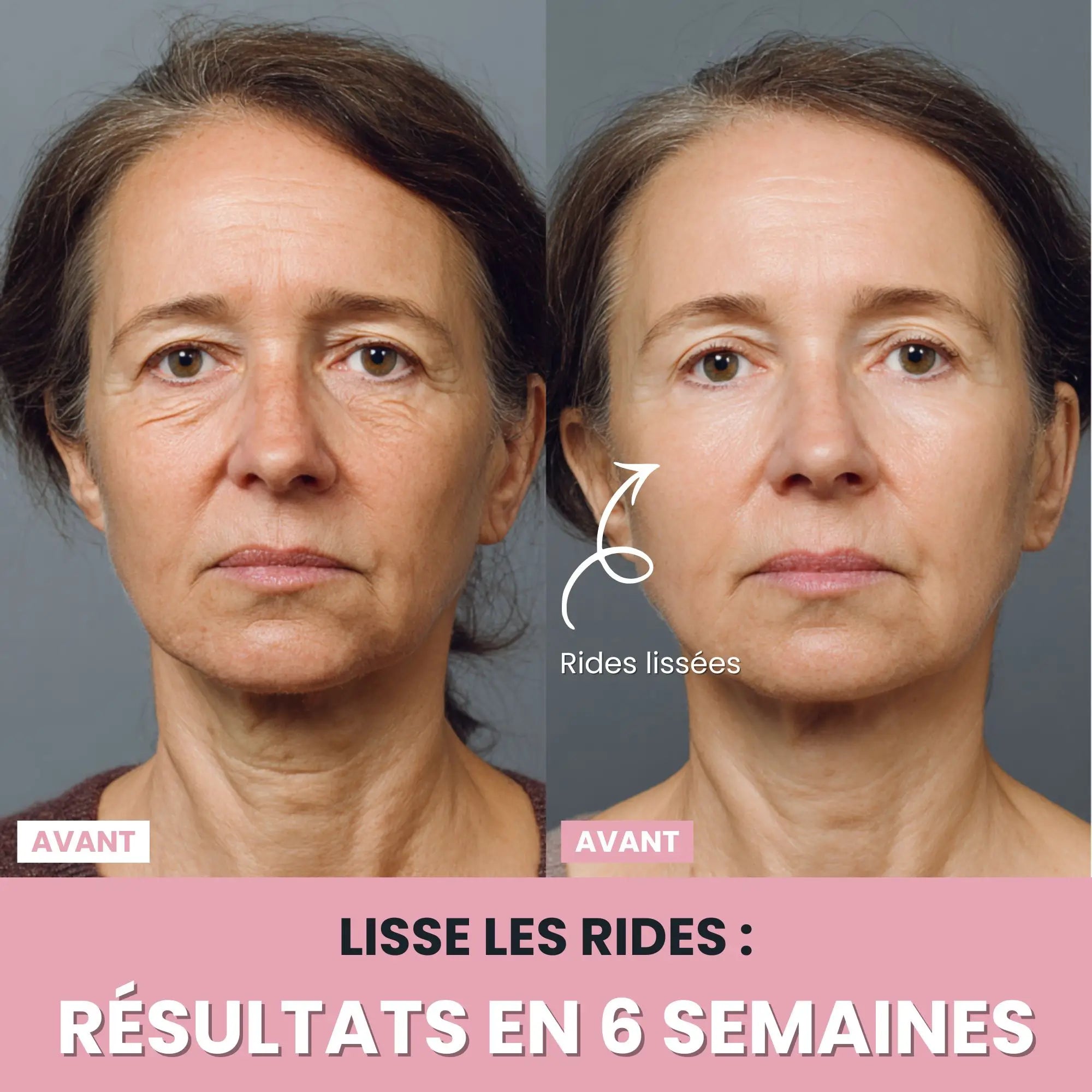 Alesia Sculteur facial LED 7 en 1